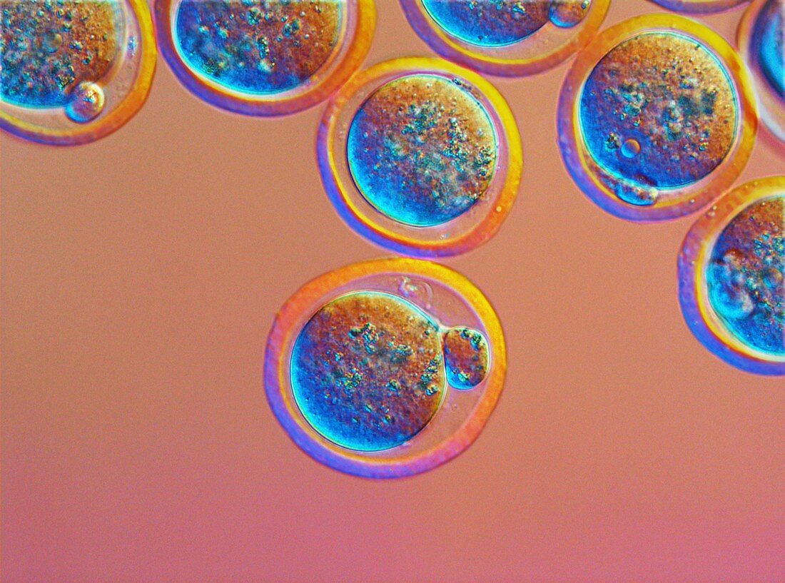 Pronuclear egg cells,light micrograph