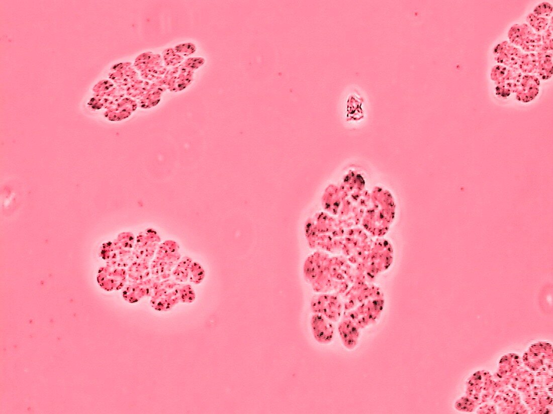 Salt lake bacteria,light micrograph