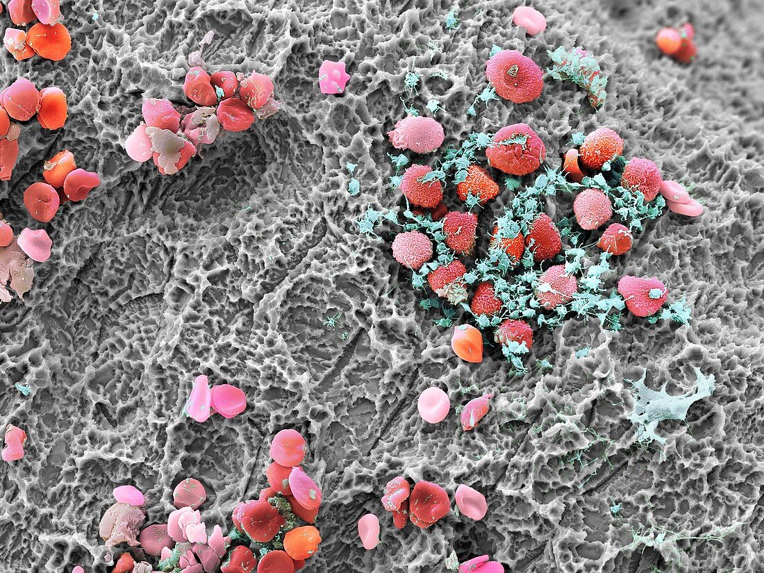 Blood clot formation,SEM