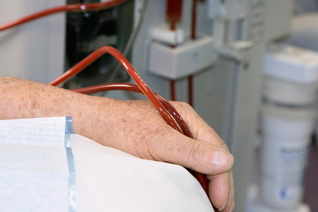 Patient lines for kidney dialysis