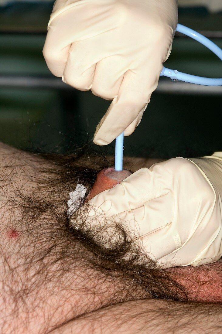 Male catheterisation