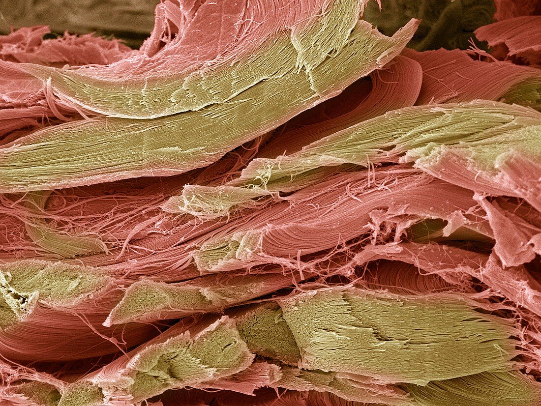 Tendon fibres,SEM