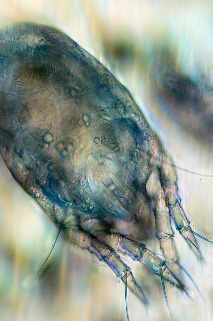 House dust mite,light micrograph