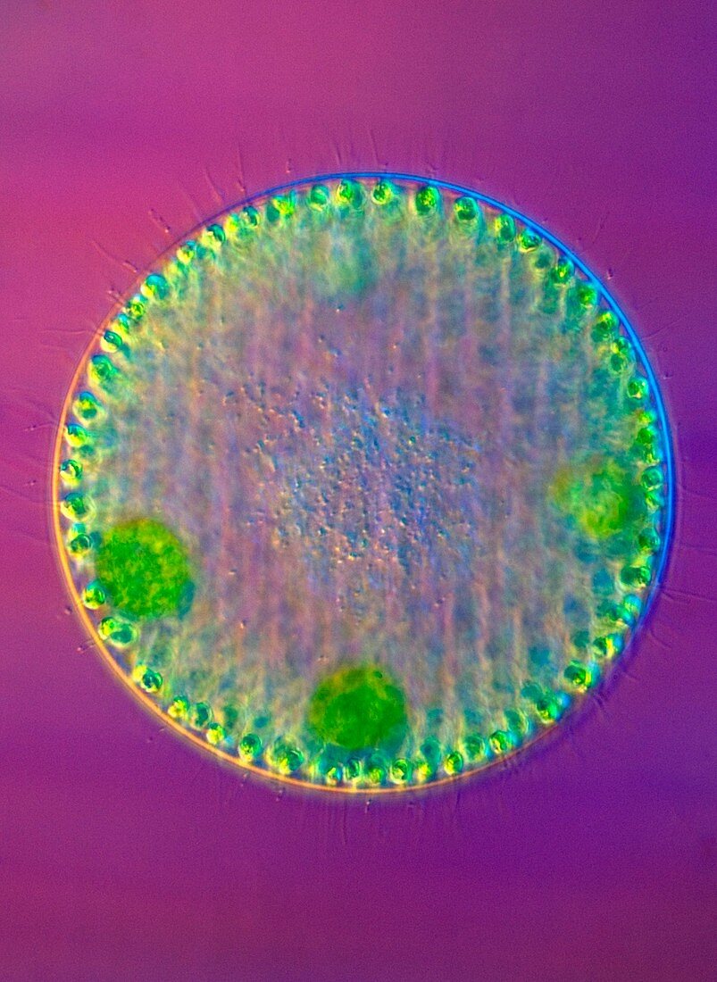 Volvox colony,light micrograph