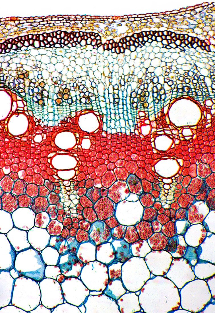 Kidney bean stem,light micrograph