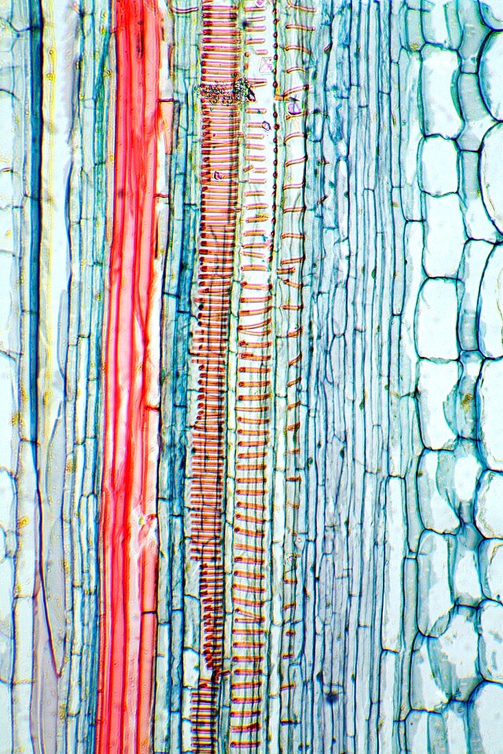 Castor oil stem,light micrograph