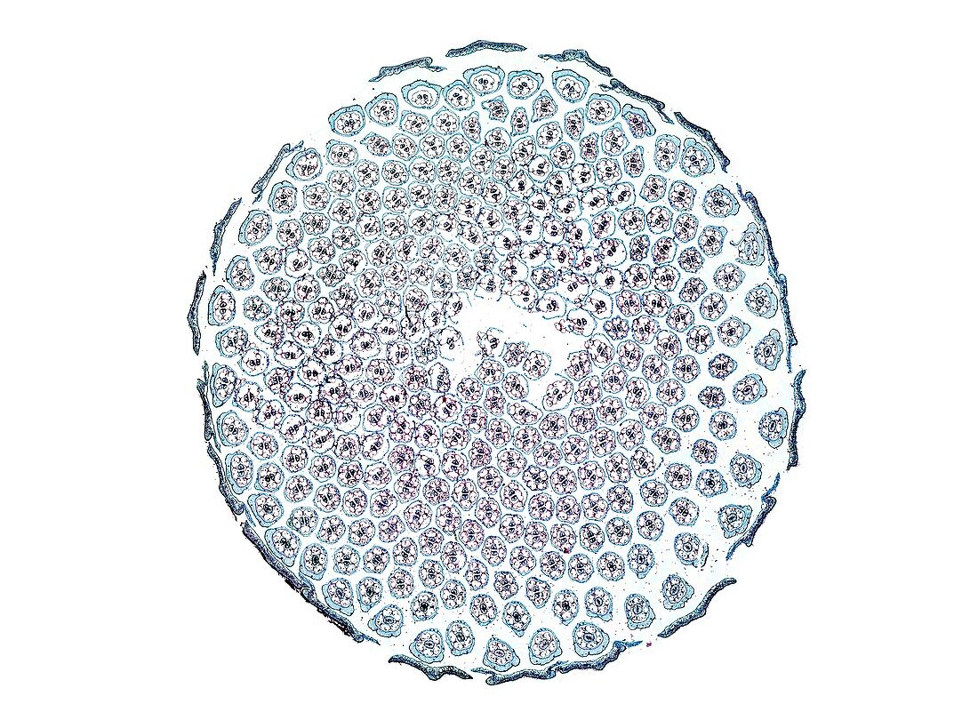 Dandelion flower head,light micrograph