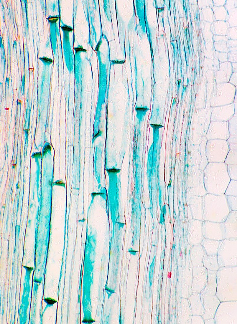 Phloem plant cells,light micrograph