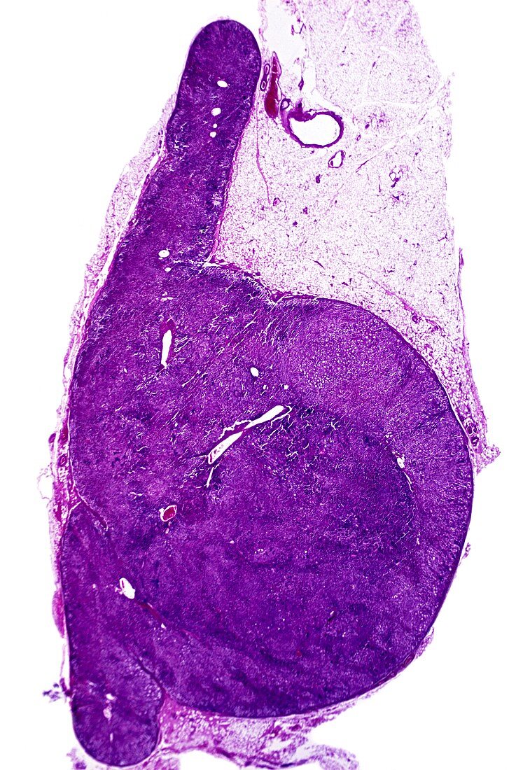 Adrenal hyperplasia,light micrograph