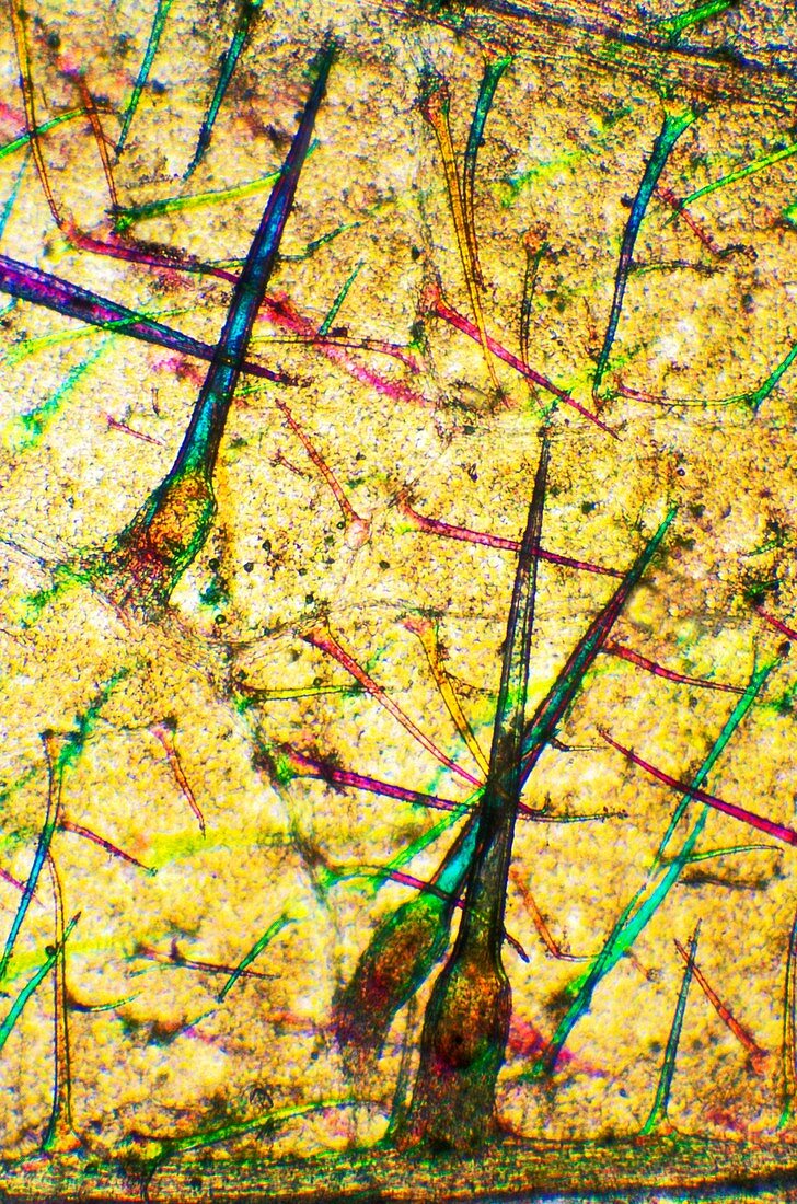 Stinging nettle leaf,light micrograph