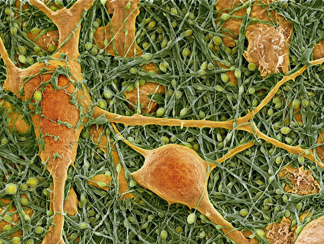 Nerve cells and glial cells,SEM