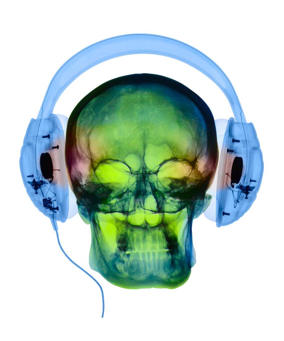 Using headphones,Coloured X-ray