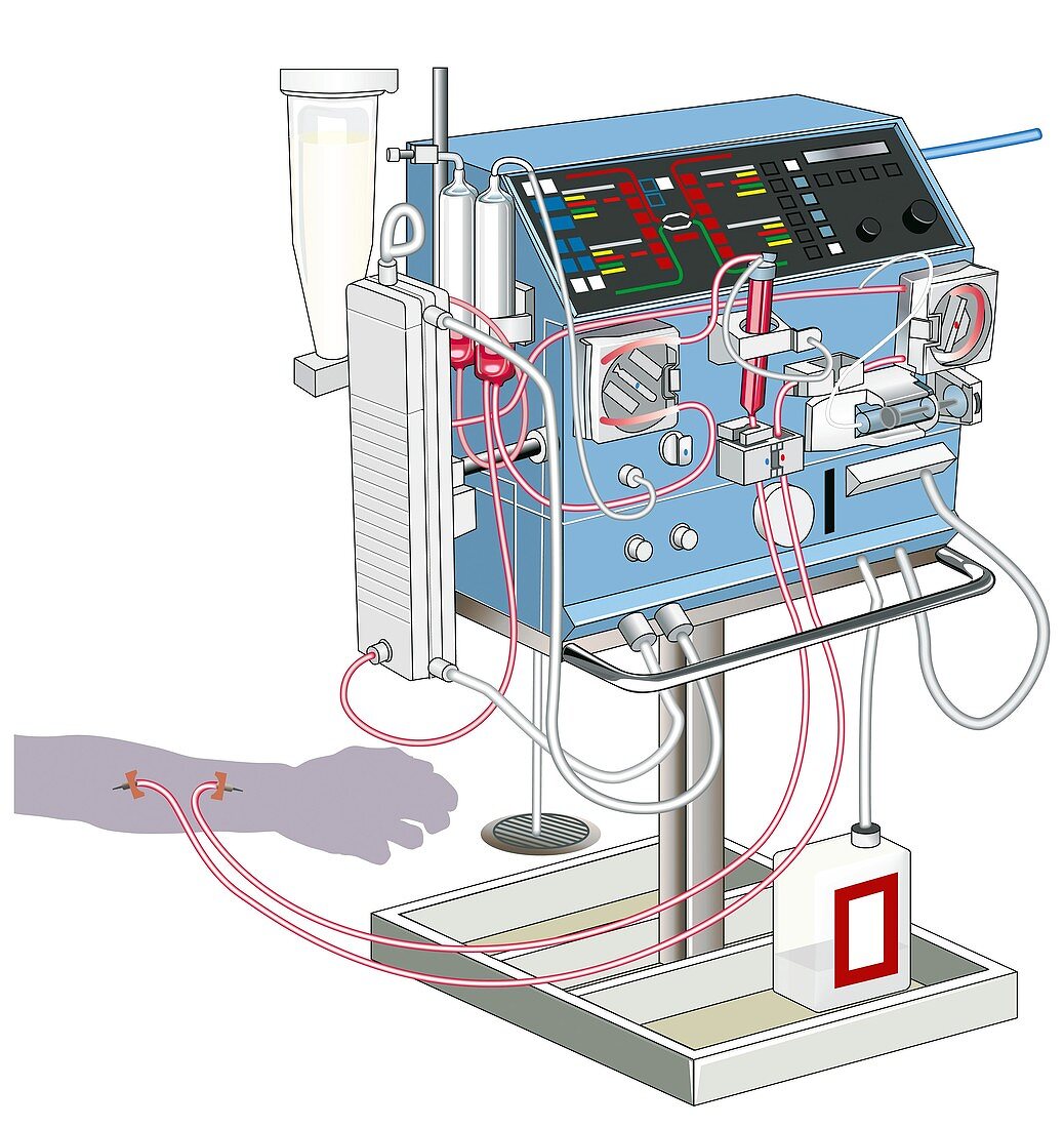 Kidney dialysis machine,artwork