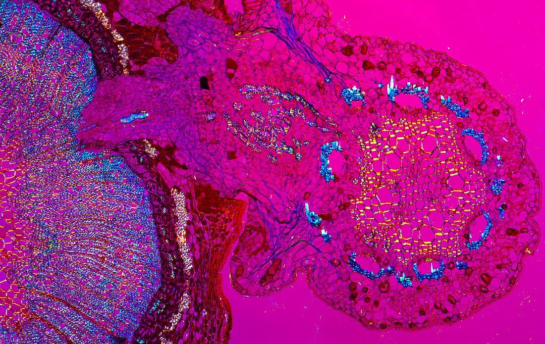 Plant parasite,light micrograph