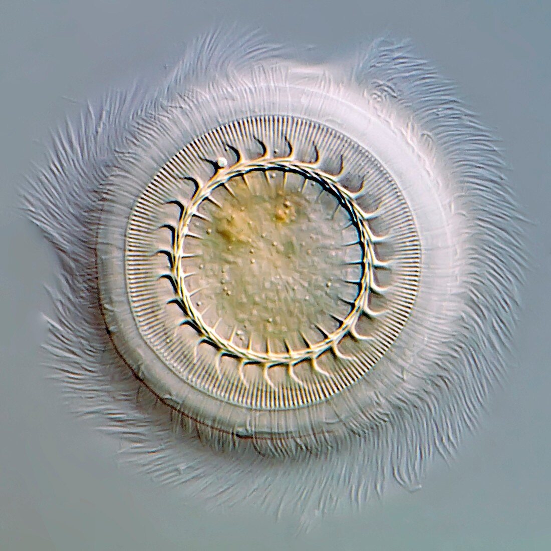 Trichodina parasite,light micrograph