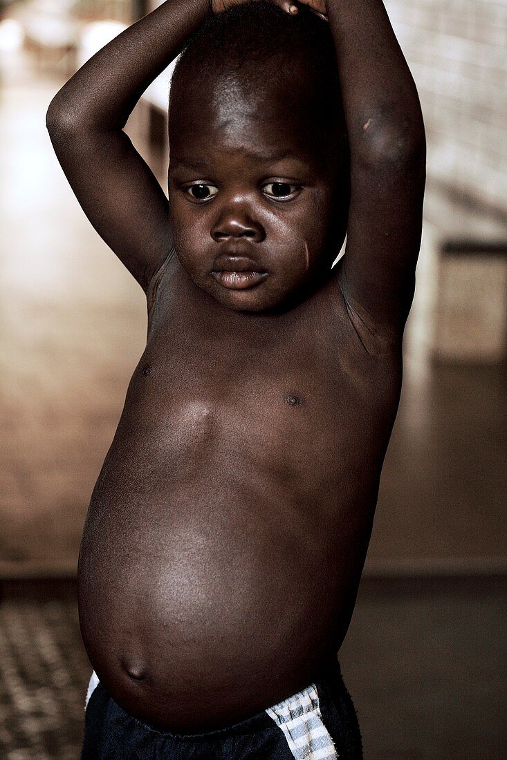 Child healthcare,Uganda