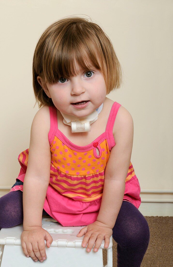 Young girl with tracheostomy
