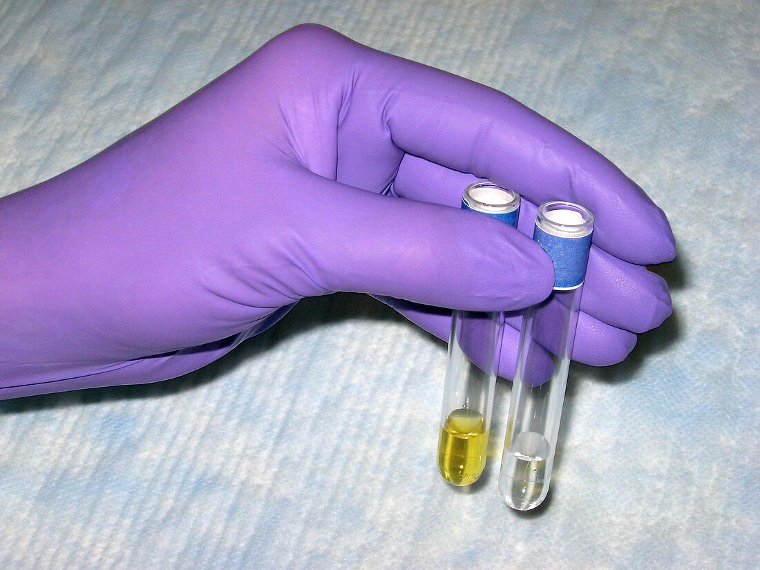 Drug contamination test