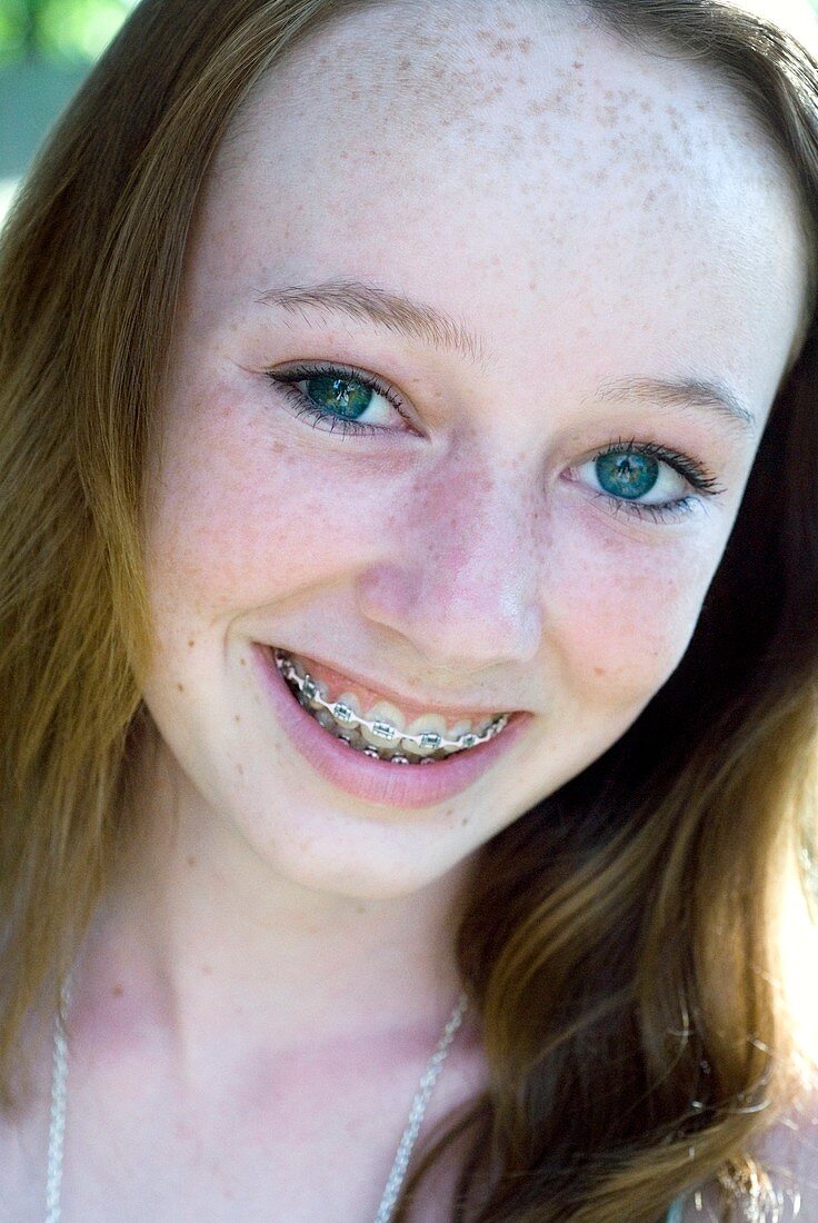Teenager with braces