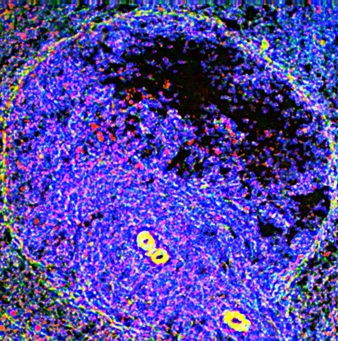 Rat spleen,fluorescence micrograph