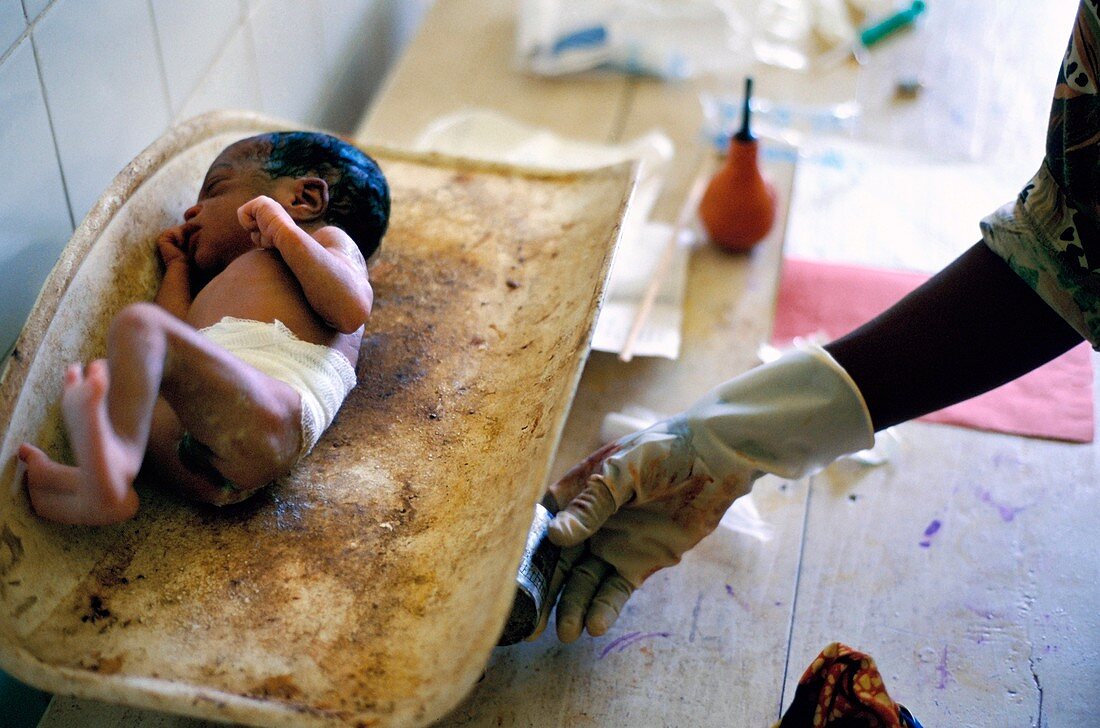 Weighing newborn baby,Congo