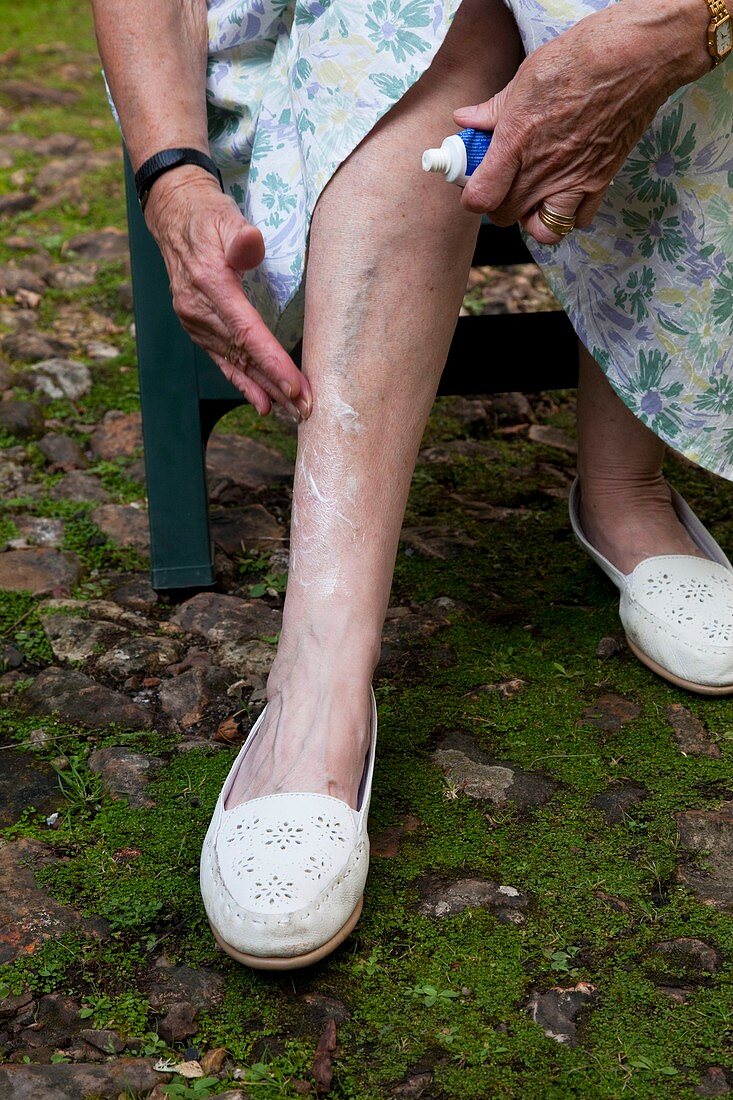 Elderly woman putting cream on her leg
