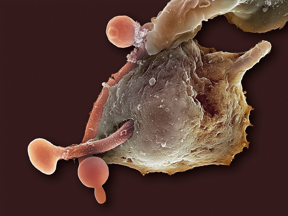 Neutrophil engulfing thrush fungus,SEM