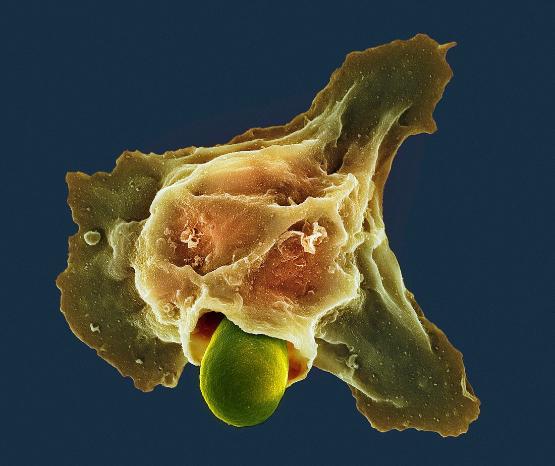 Neutrophil engulfing thrush fungus,SEM