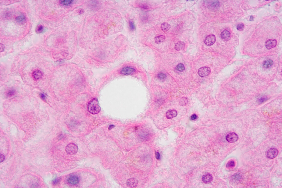 Cross-section of human liver LM X250