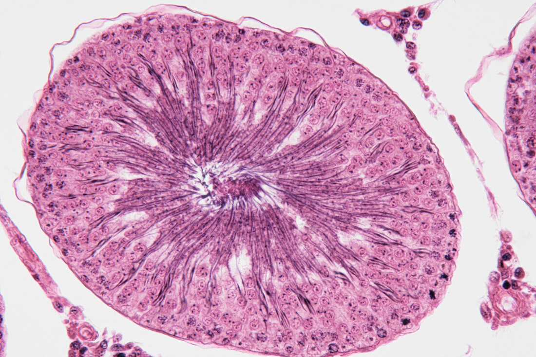 Seminiferous tubule in testis