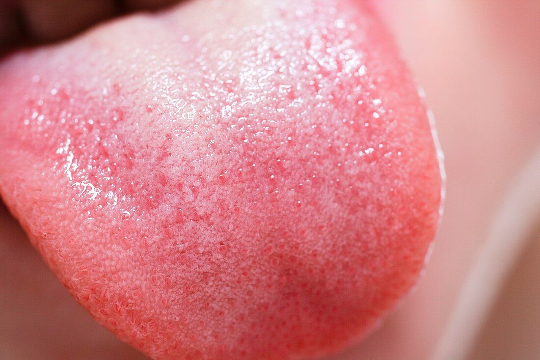 Close-up of child's tongue