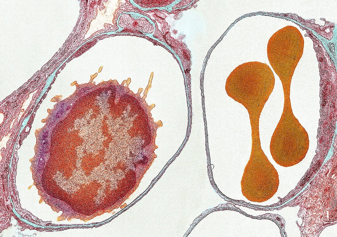 Lung alveoli and blood cells,TEM