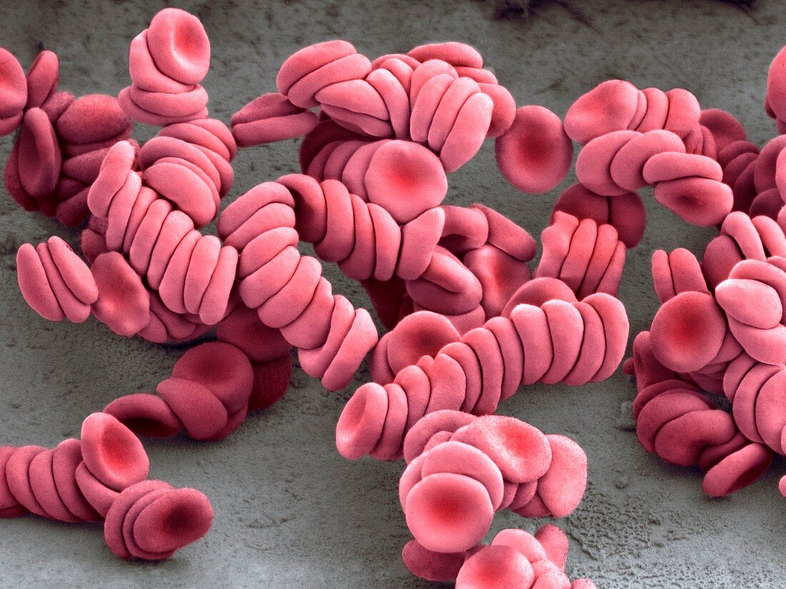 Stacked red blood cells,SEM