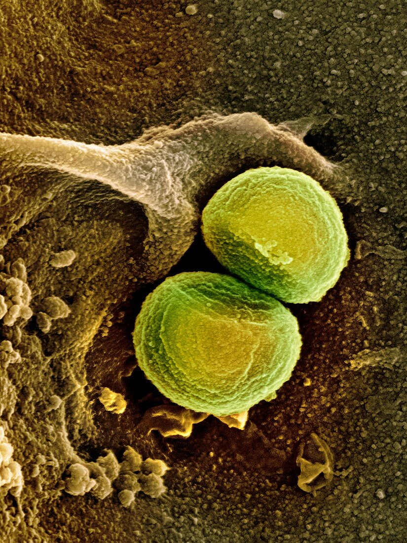 Staphylococcus aureus bacteria,SEM