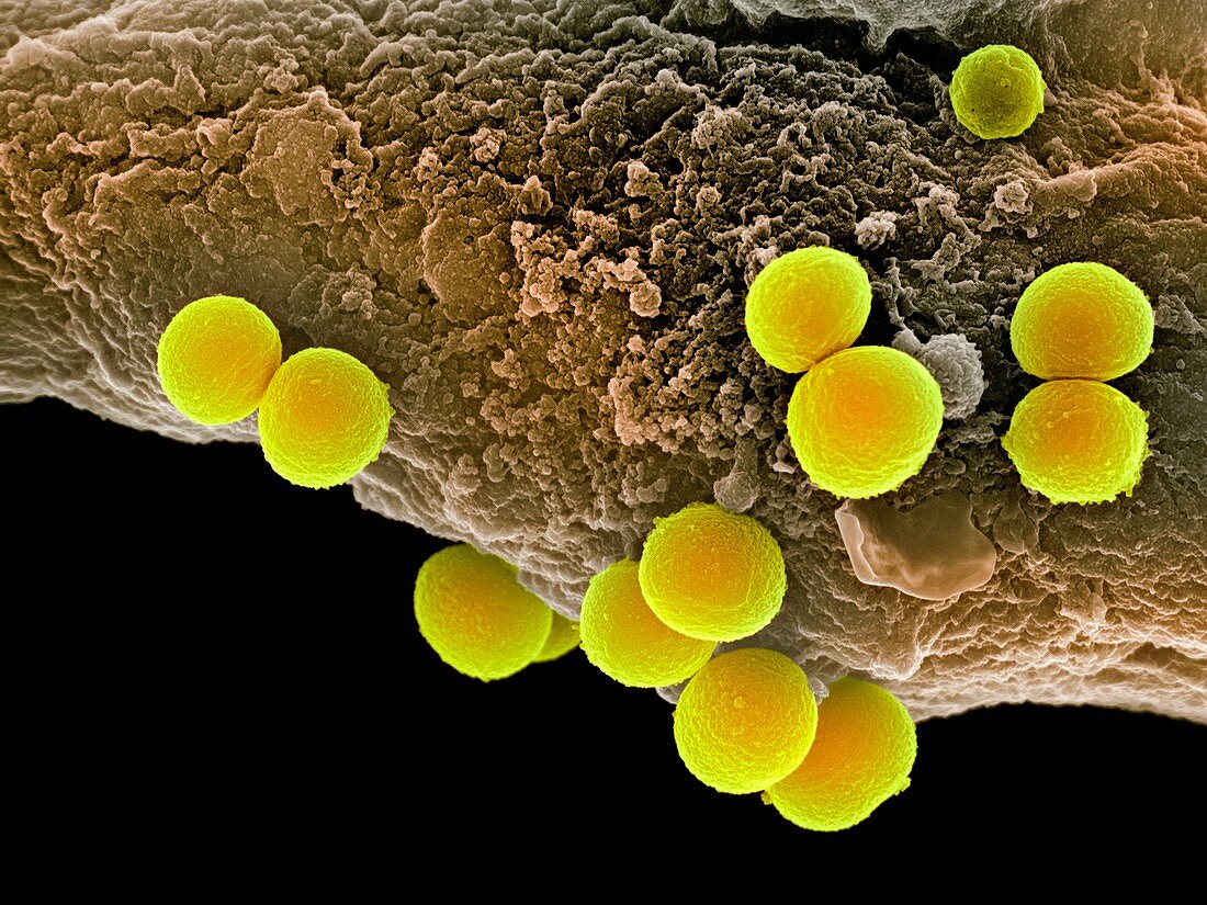 Staphylococcus aureus bacteria,SEM