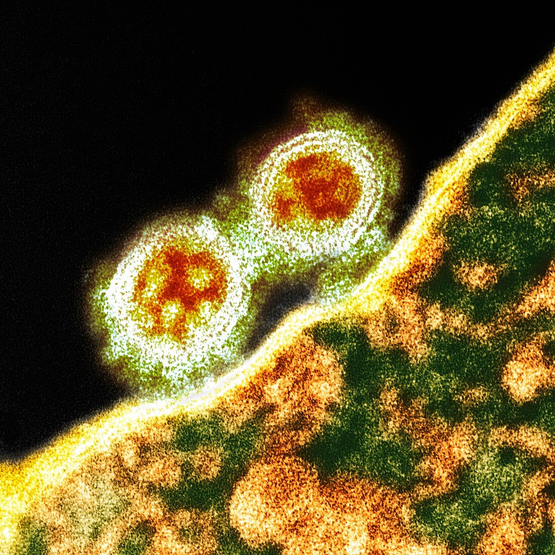 H1N1 swine flu virus,TEM