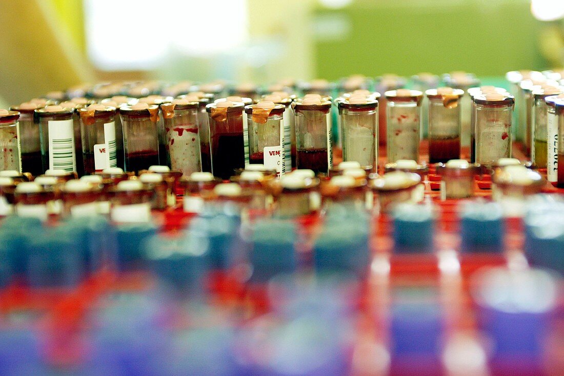 Blood donation testing vials