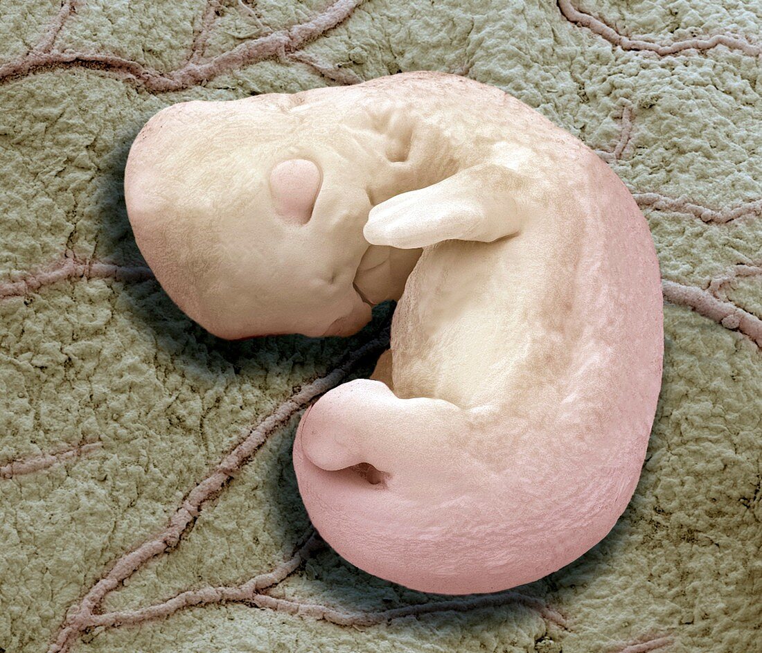 Cat foetus,SEM