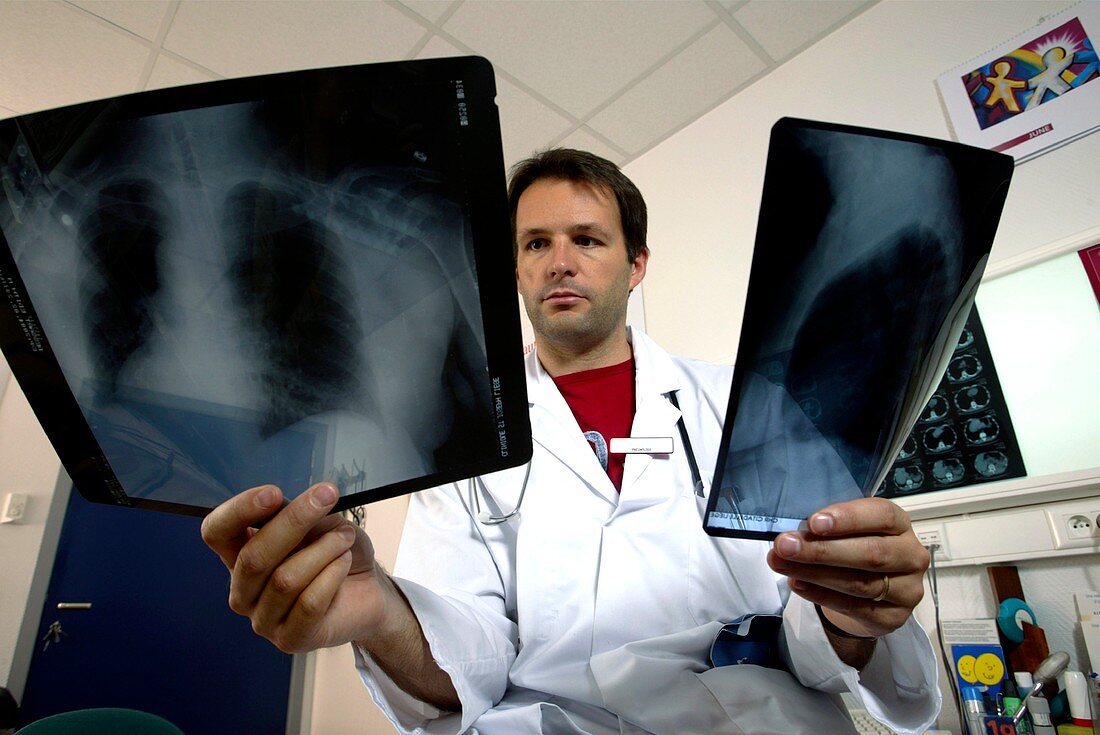 Lung X-ray examination