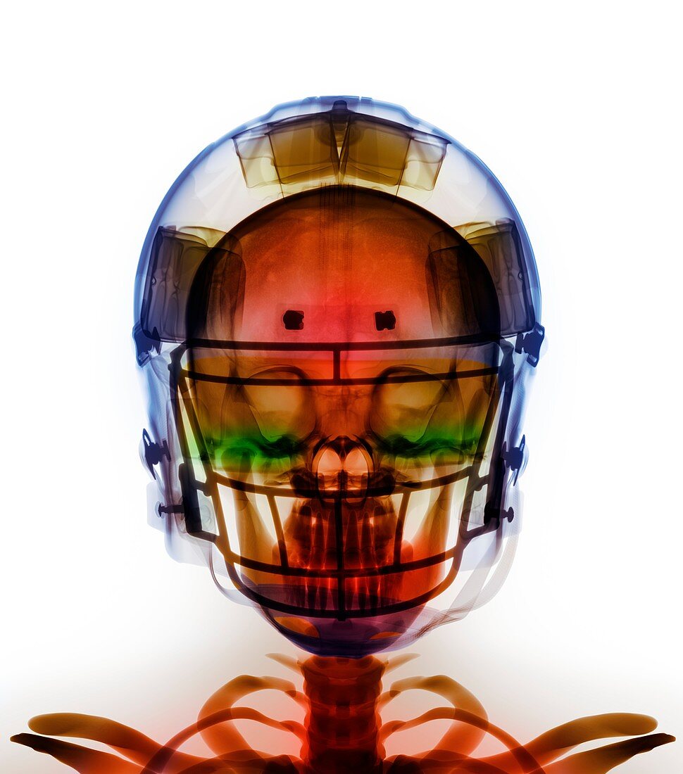 American football helmet,X-ray