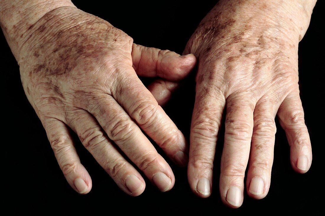 Elderly woman's hands