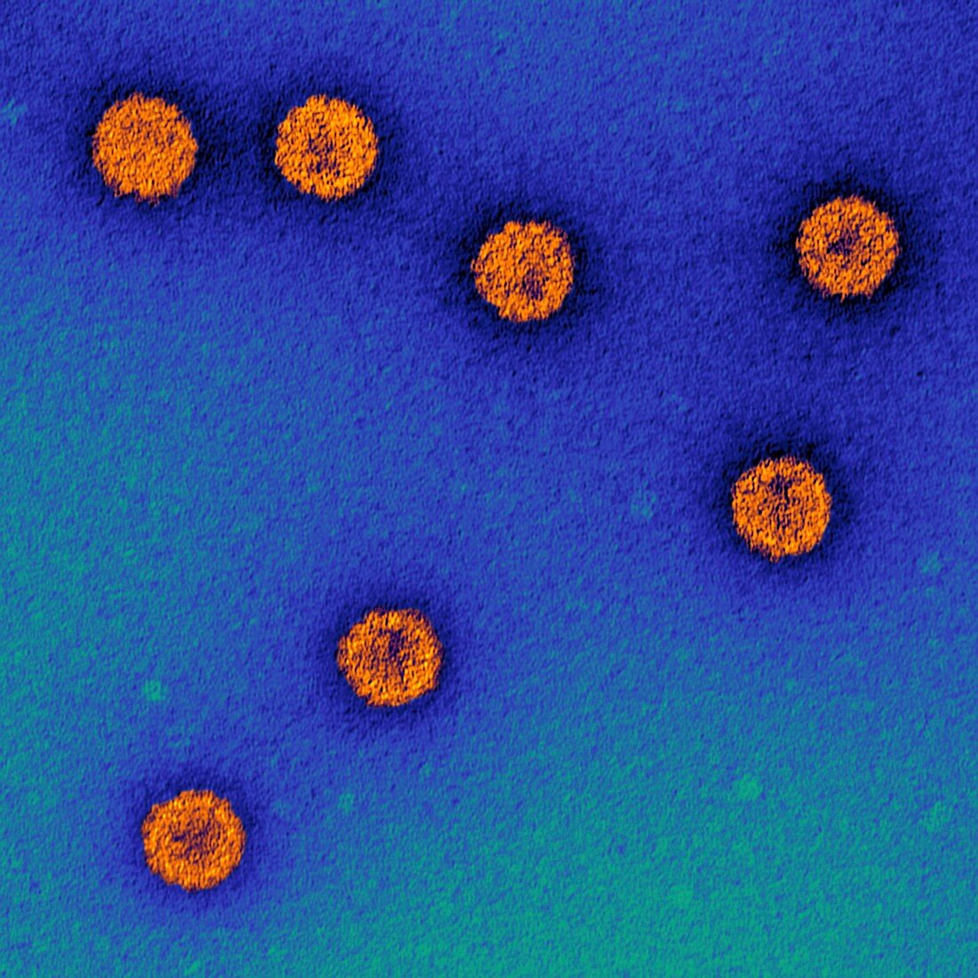 Human papillomavirus particles,TEM