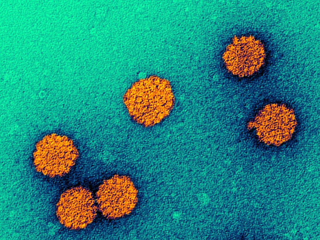Human papillomavirus particles,TEM