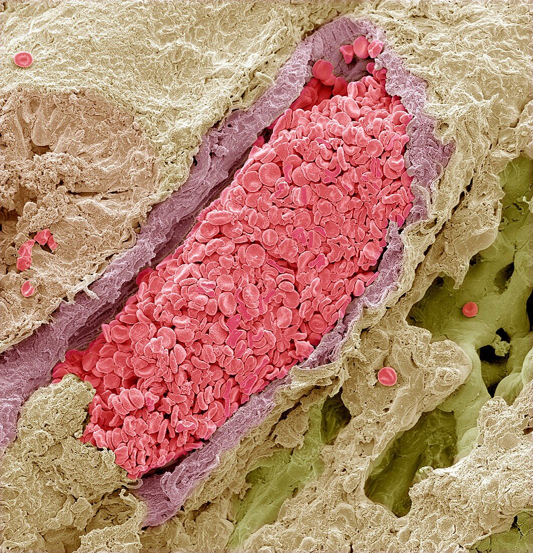 Blood-filled pulmonary vein,SEM