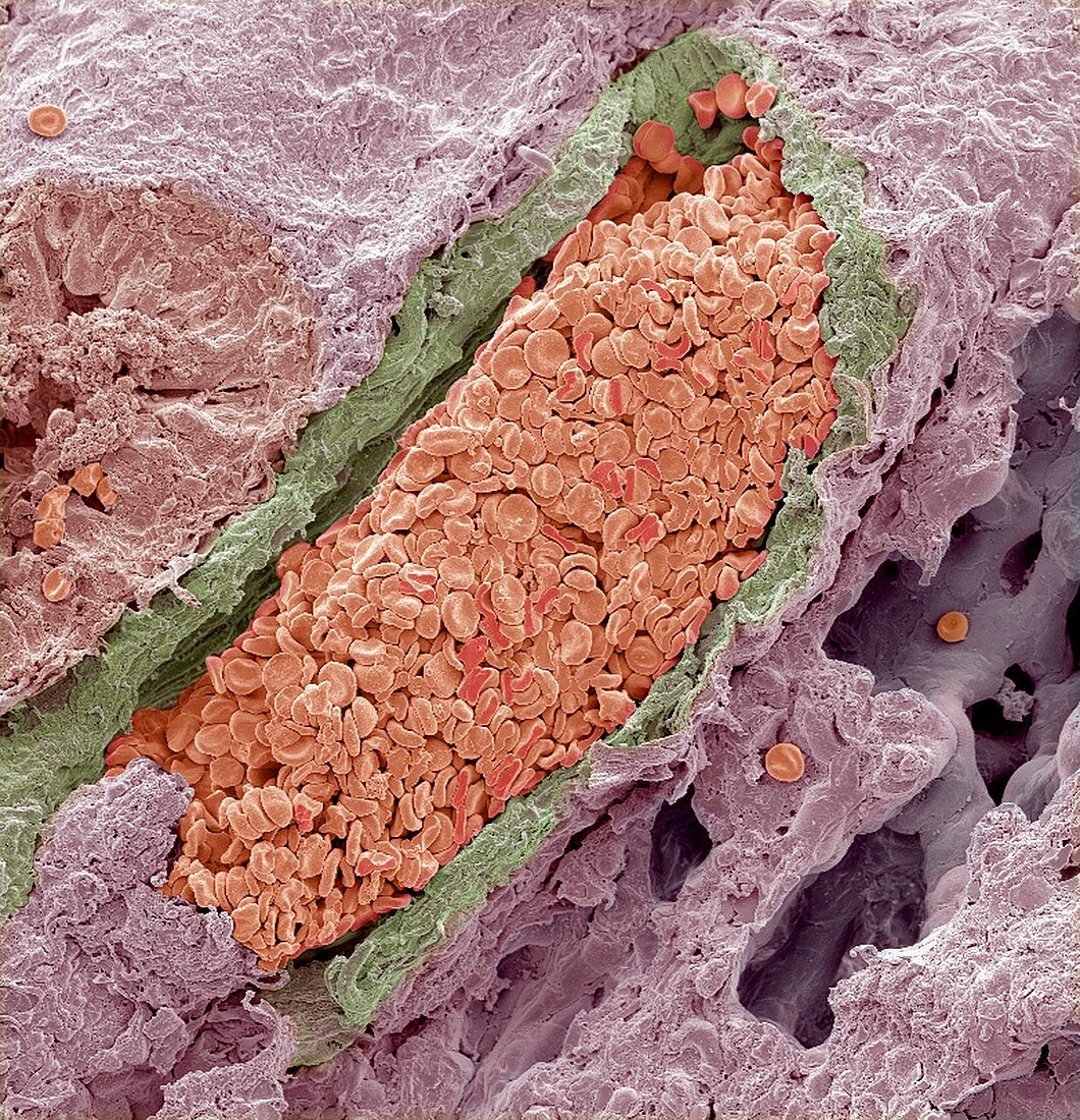 Blood-filled pulmonary vein,SEM