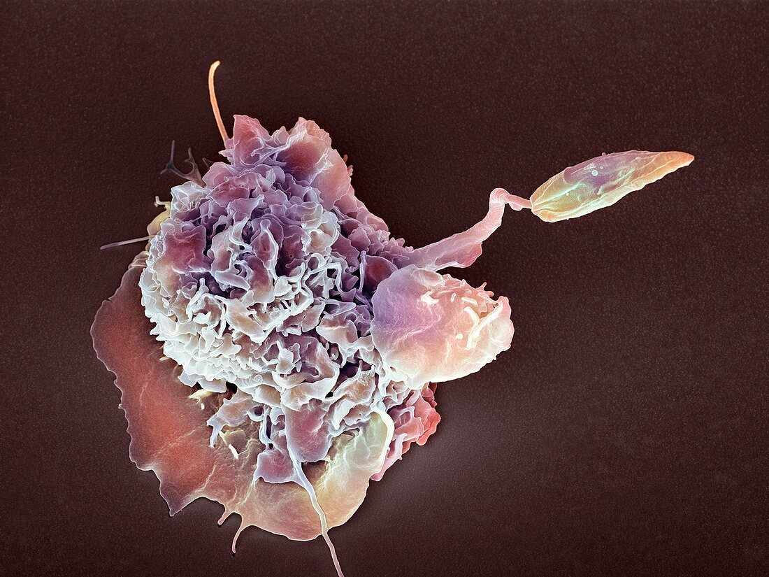 Macrophage attacking a foreign body,SEM