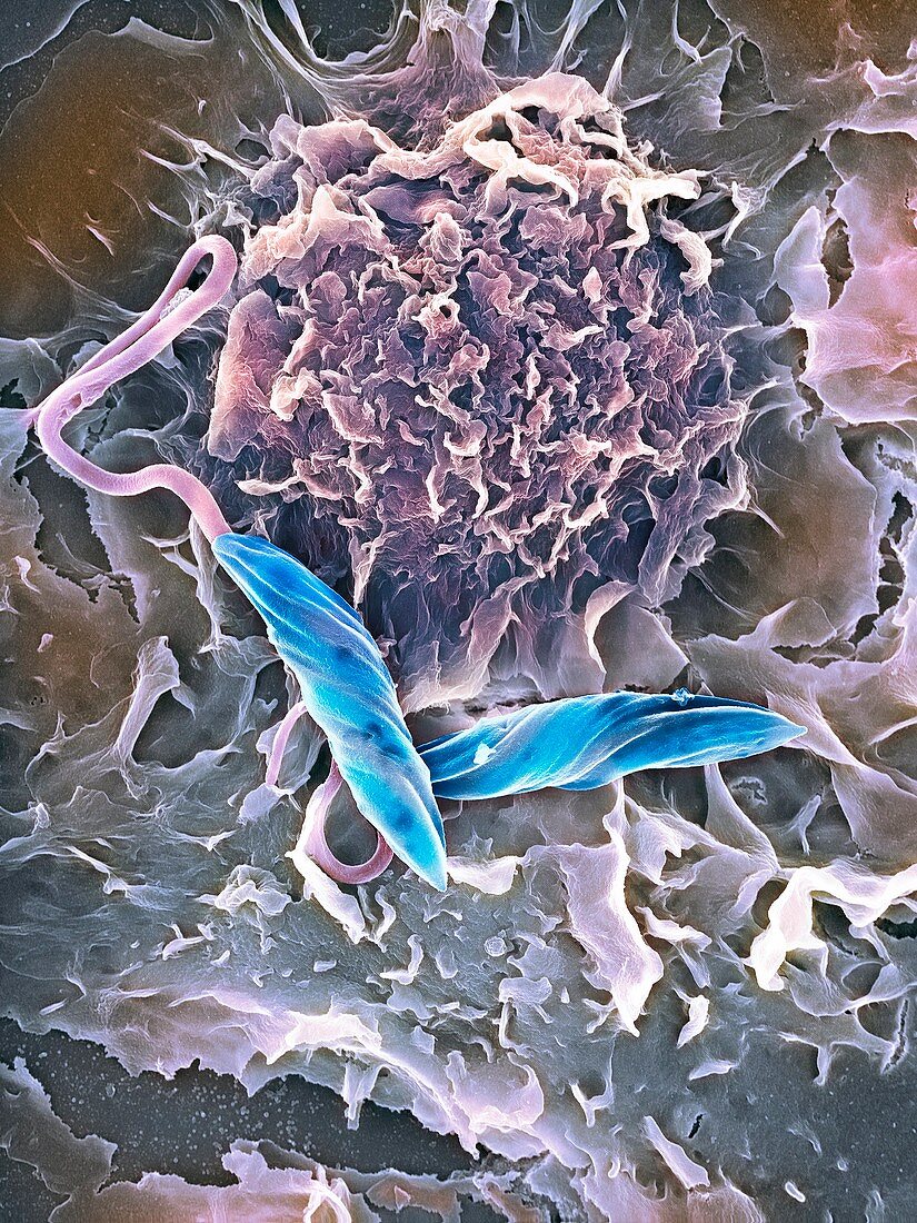 Macrophage attacking a foreign body,SEM