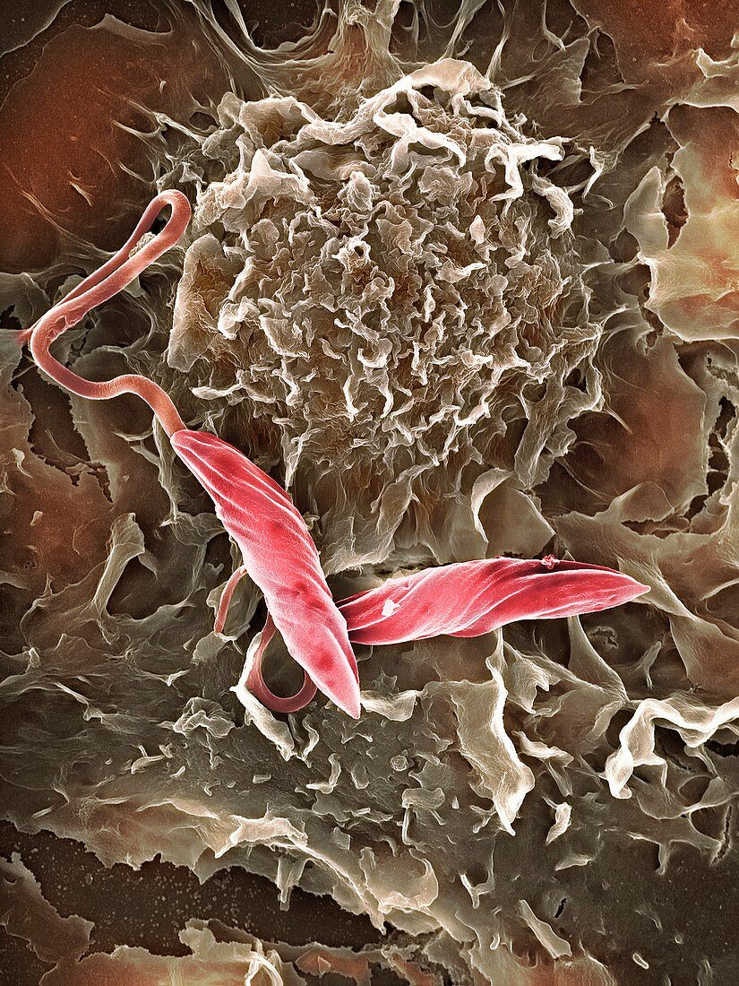 Macrophage attacking a foreign body,SEM