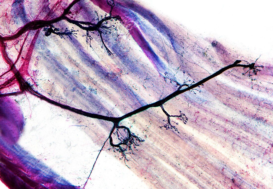 Muscle motor neurones,light micrograph