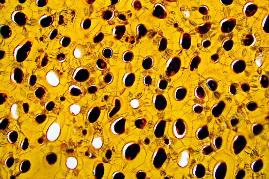Strychnine seed tissue,light micrograph